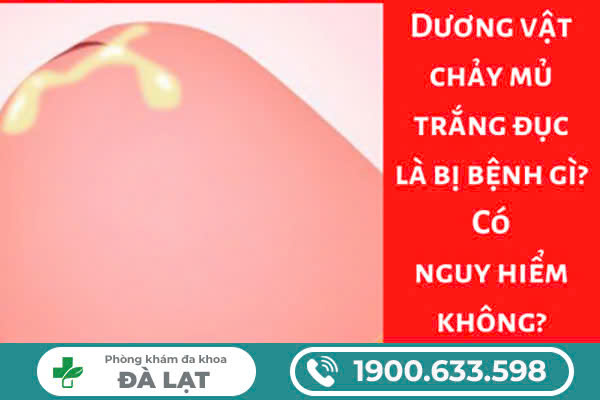 TÌM HIỂU VỀ DƯƠNG VẬT CÓ MỦ TRẮNG Ở NAM GIỚI